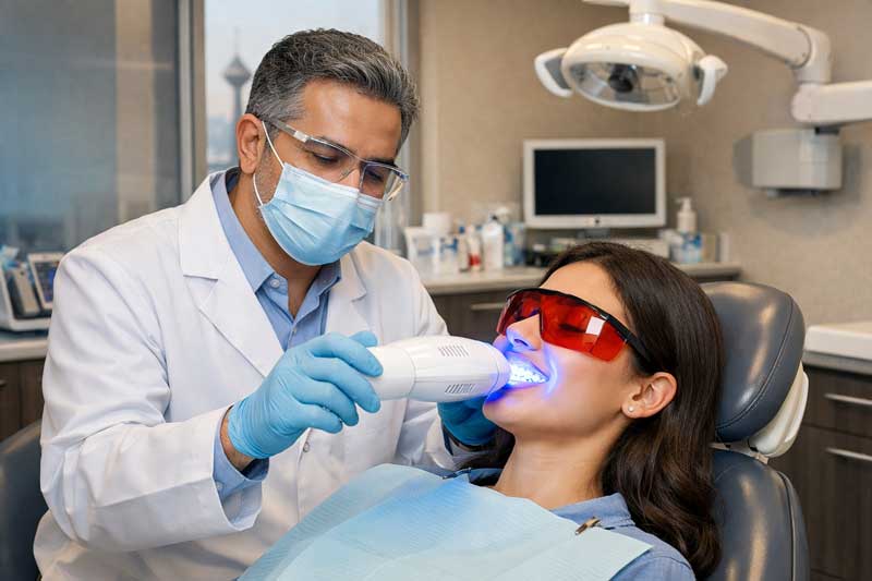 بلیچینگ دندان غرب تهران