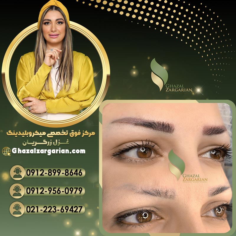 ریموو تاتو ابرو به صورت اصولی