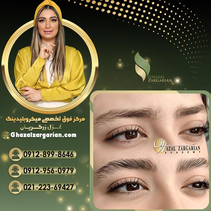 هزینه لیفت ابرو با مواد با متخصص حرفه ای