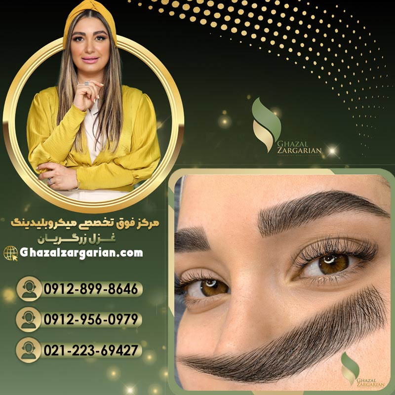 میکروبلیدینگ غزل زرگریان به صوت حرفه ای و تخصصی
