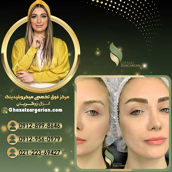 میکروبلیدینگ ابرو با ماندگاری و تثبیت حرفه ای