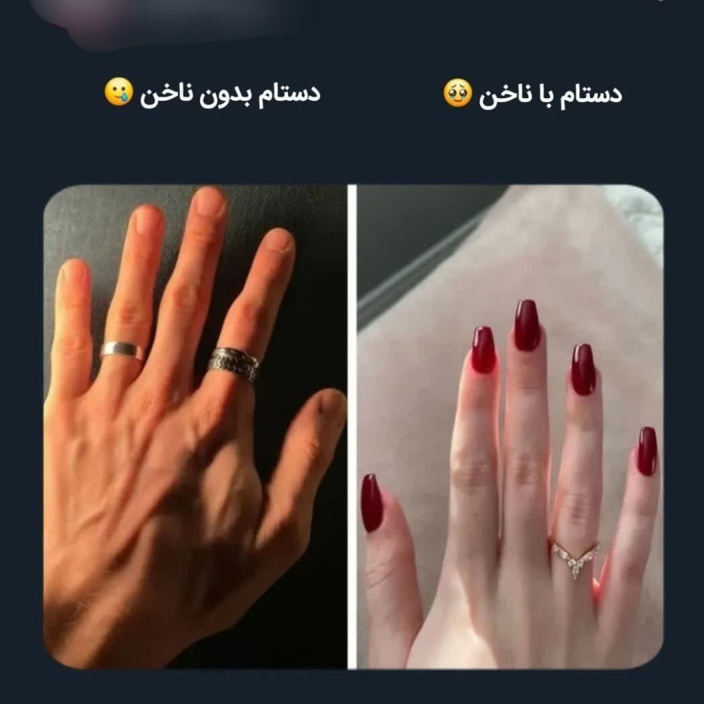 ناخن/