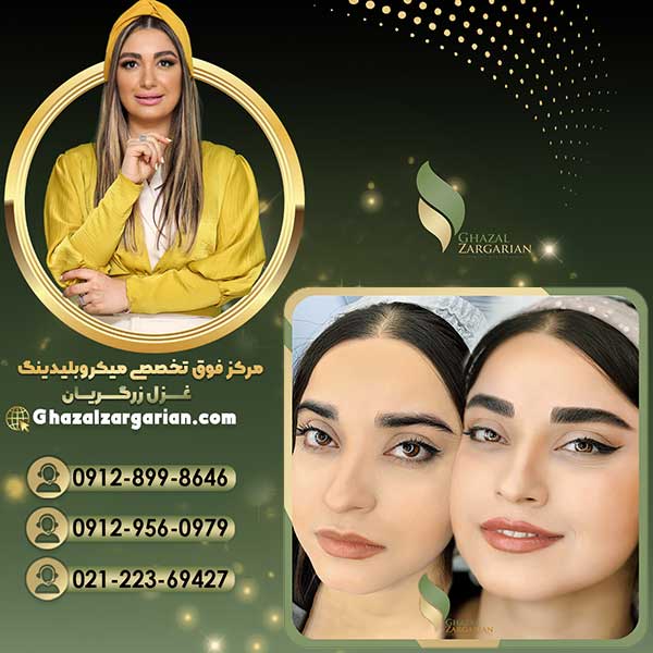 میکروبلیدینگ برای پرپشت سازی ابرو