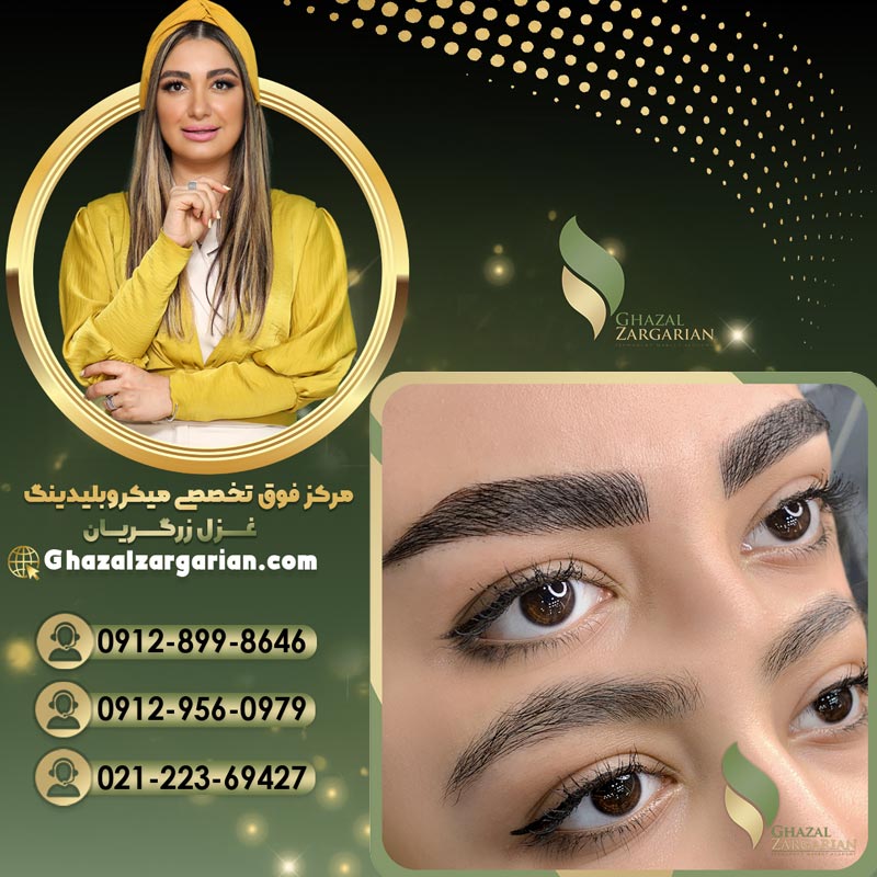 میکروبلیدینگ غزل زرگریان بدون عوارض