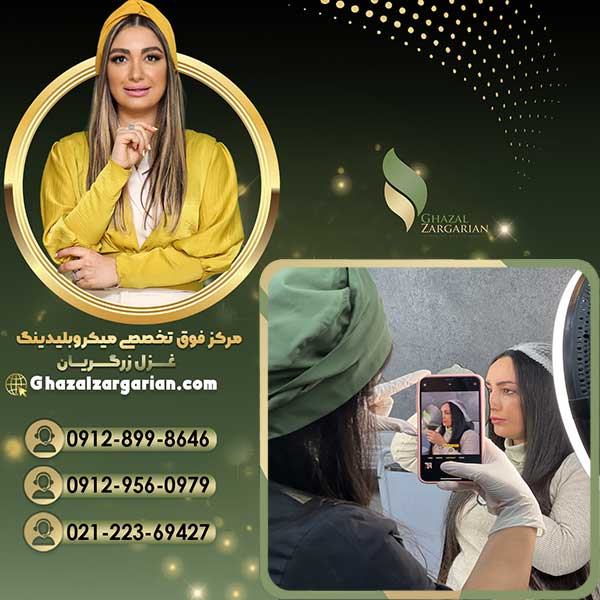 هاشور کرکی با بهترین مسترها