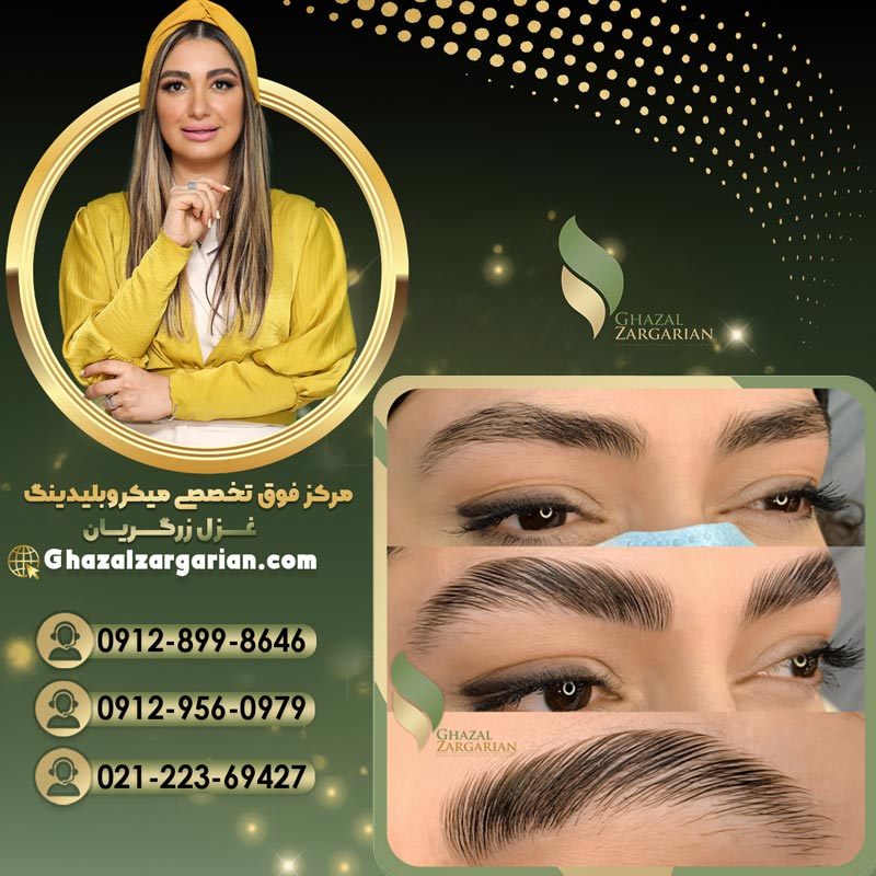 قیمت لیفت و لمنیت ابرو با تضمین بهترین کیفیت