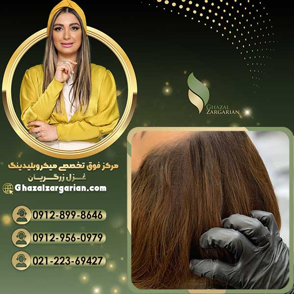 هاشور اسکالپ سر با رنگدانه های مخصوص