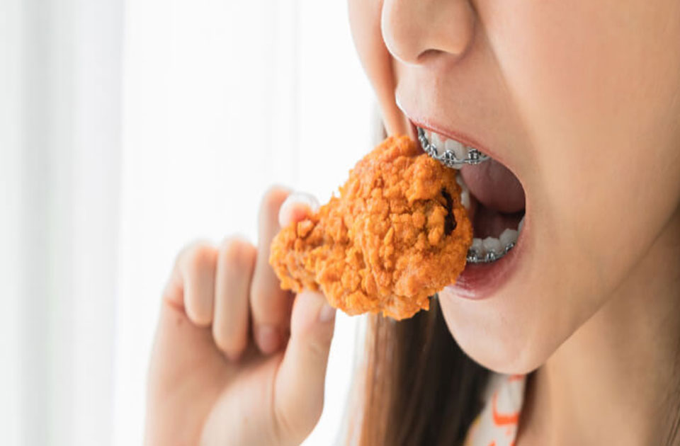 تغذیعه مناسب برای ارتودنسی 