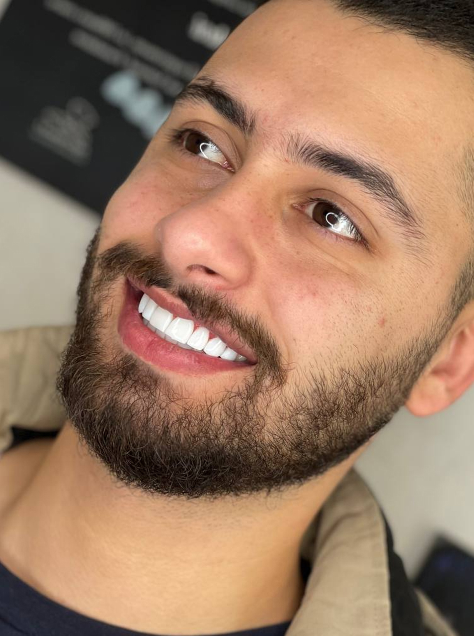 لمینت
سرامیکی درخشان