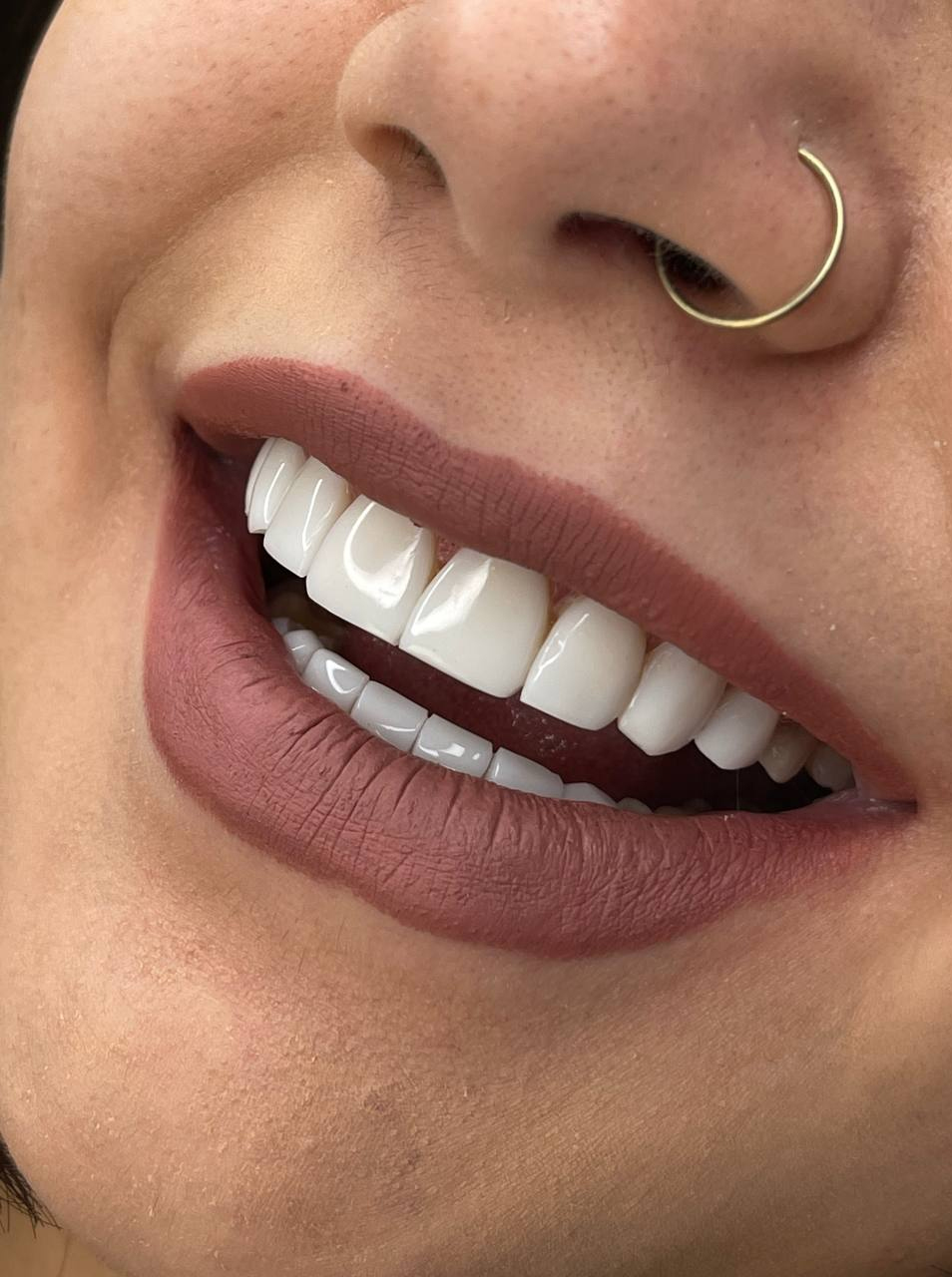 طراحی
لبخند طبیعی