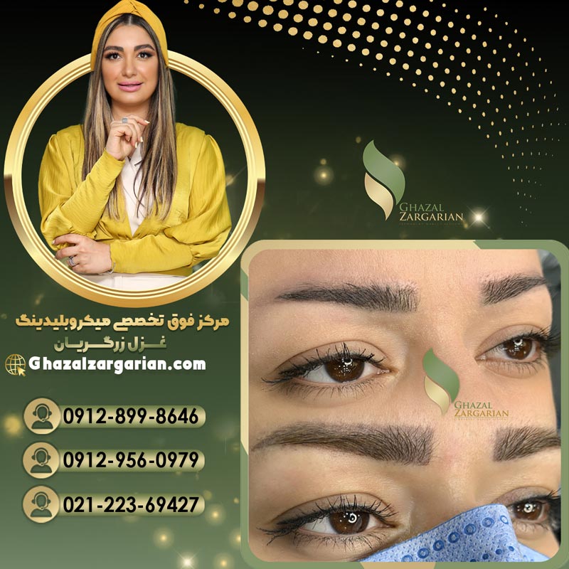 پاک کردن تاتو ابرو با بهترین تکنیک