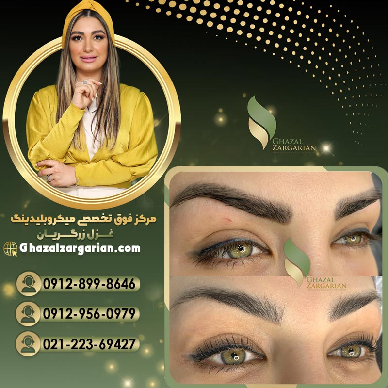 پاک کردن میکروبلیدینگ ابرو در بهترین مرکز
