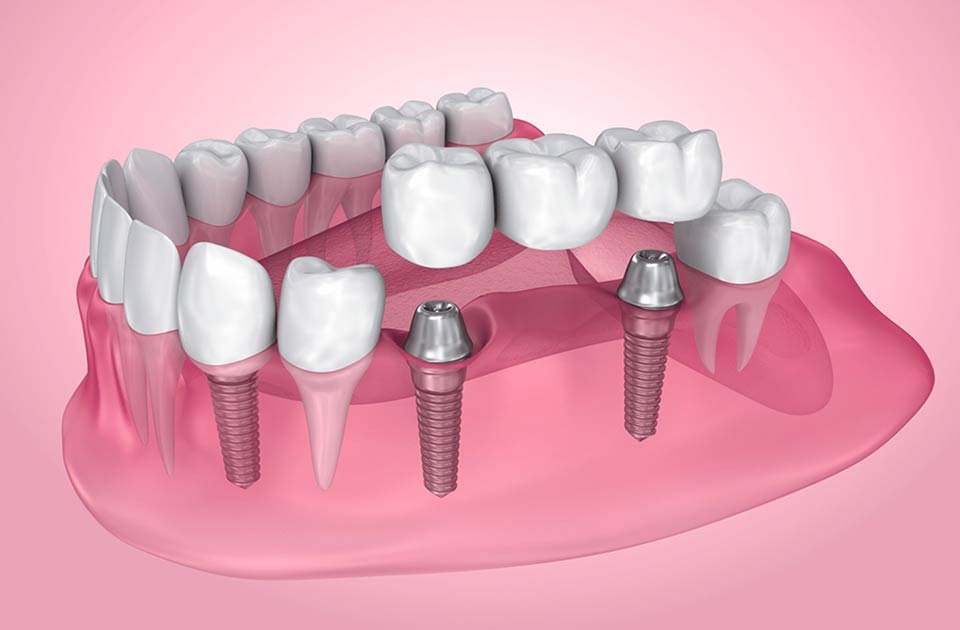 دندان، دندانپزشکی کرج ، دندانپزشکی شبانه روزی ، دندانپزشکی دریا 