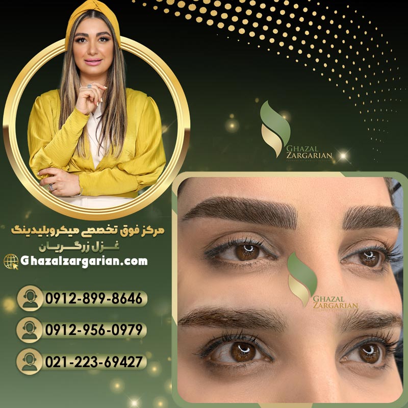 فیبروز ابرو با روش های پیشرفته