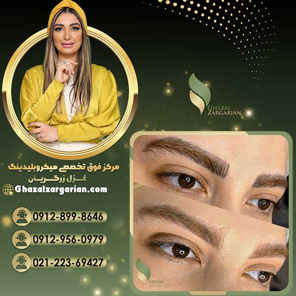 ریموو تاتو ابرو با بروزترین تکنیک ها