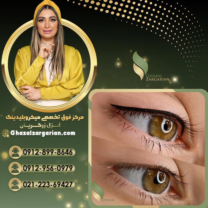 هاشور خط چشم بر اساس فرم چشم
