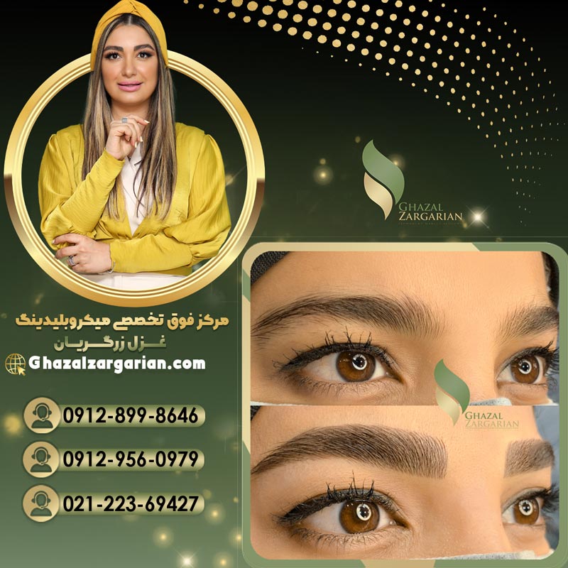 میکروبلیدینگ ابرو با بی حسی عقرب
