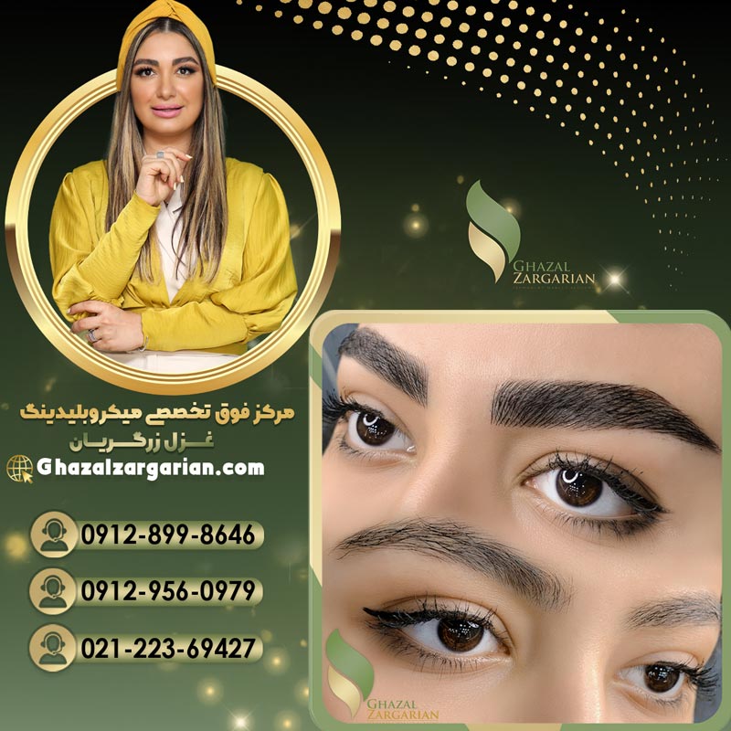 فیبروز ابرو با رعایت نکات بهداشتی