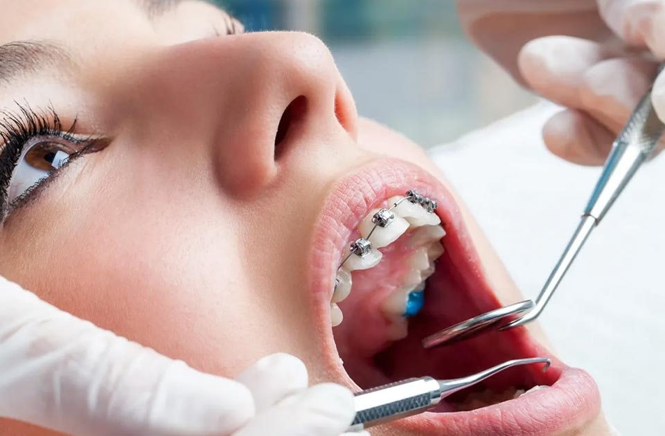 ارتودنسی دندان چیه