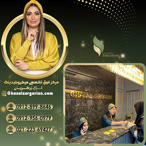 بلید ابرو در مرکز غزل زرگریان
