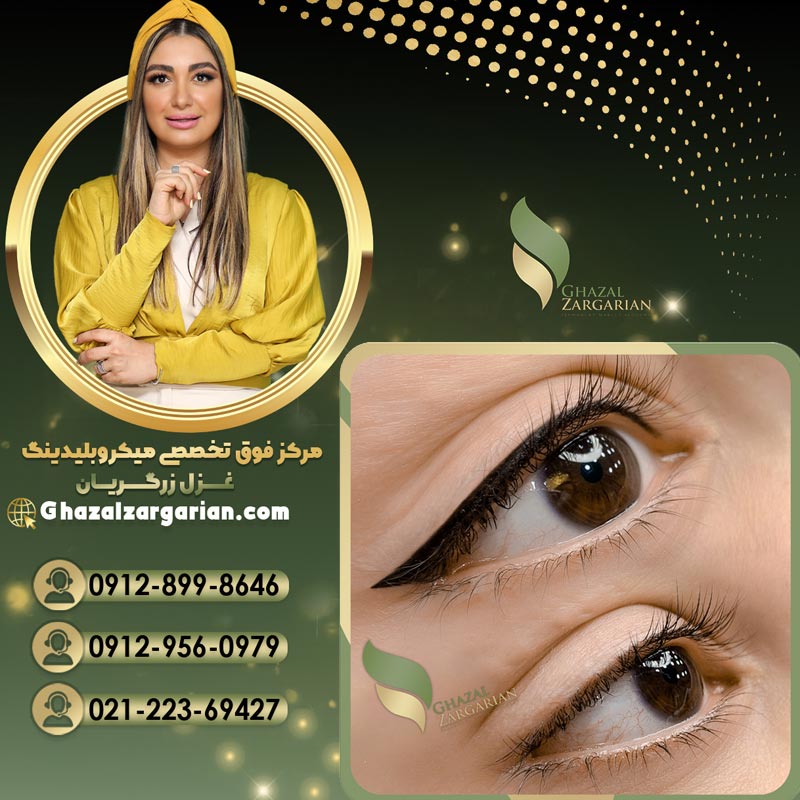 هاشور خط چشم با بهترین متخصص