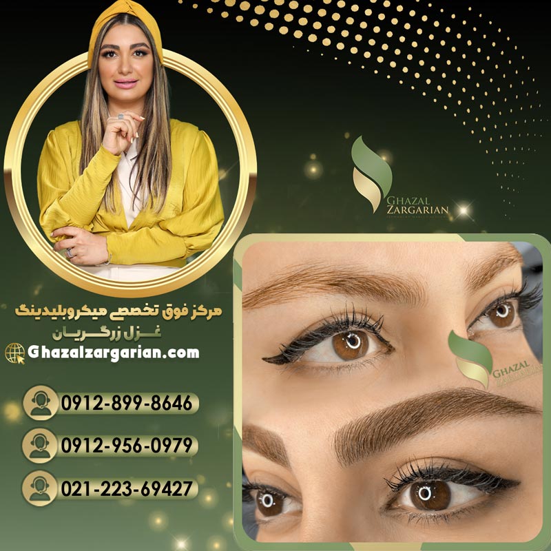 هاشور کرکی بدون عوارض