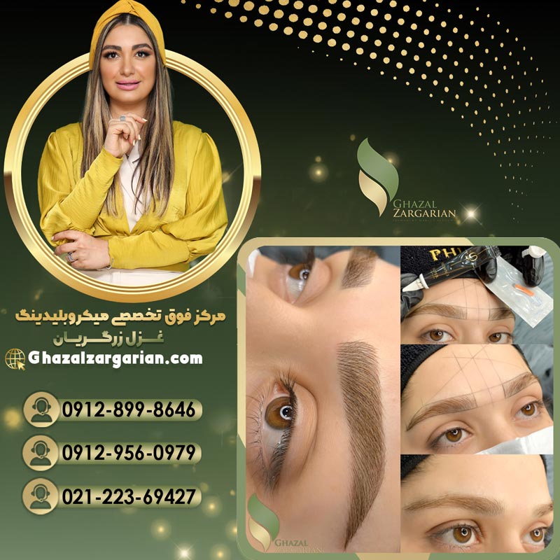 میکرو ابرو با بهترین بی حسی