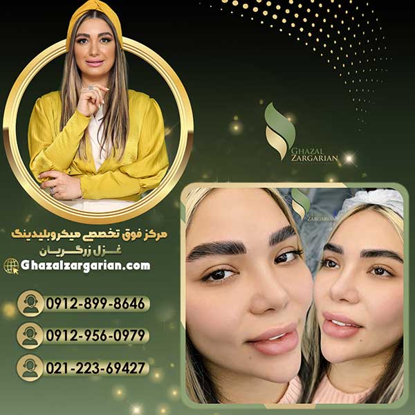 قیمت لیفت و لمنیت ابرو با روش های جدید