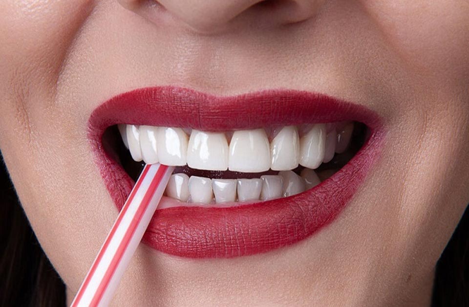 ویژگی های کامپوزیت آی پی اس 