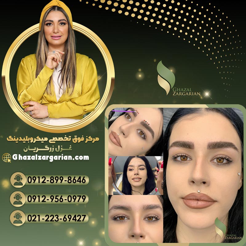 میکروبلیدینگ غزل زرگریان با بروزترین تکنیک