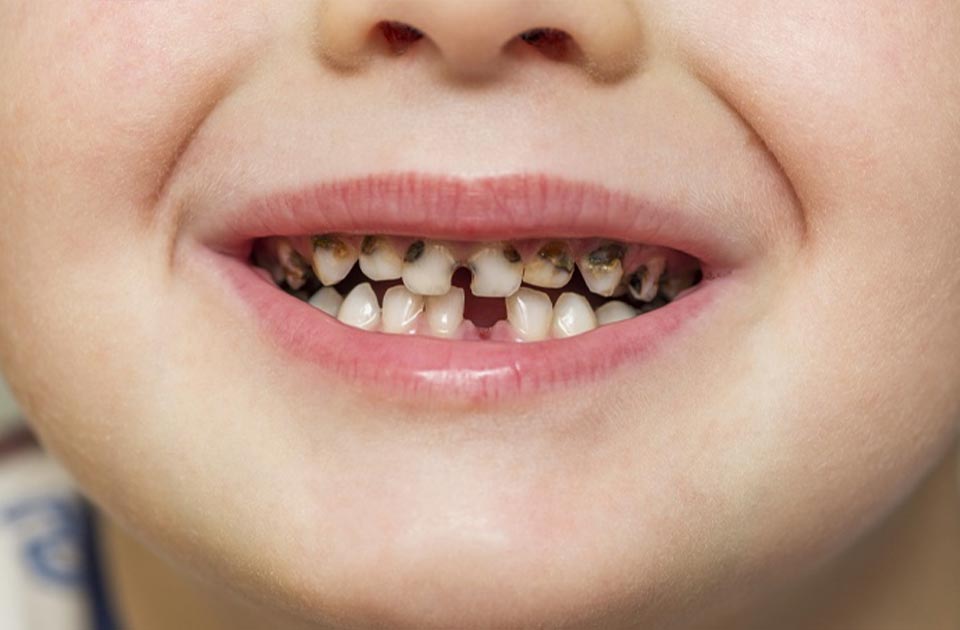 آموزش به کودکان ، دندانپزشکی اطفال کرج 