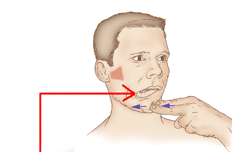 علل انحراف فک 