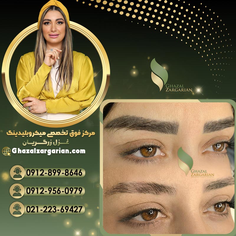 آموزش ریموو ابرو با استاد غزل زرگریان