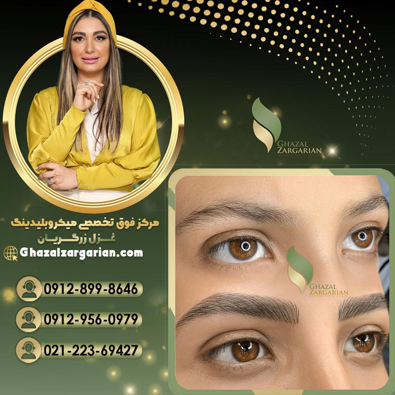 میکروبلیدینگ با تکنیک های اصولی
