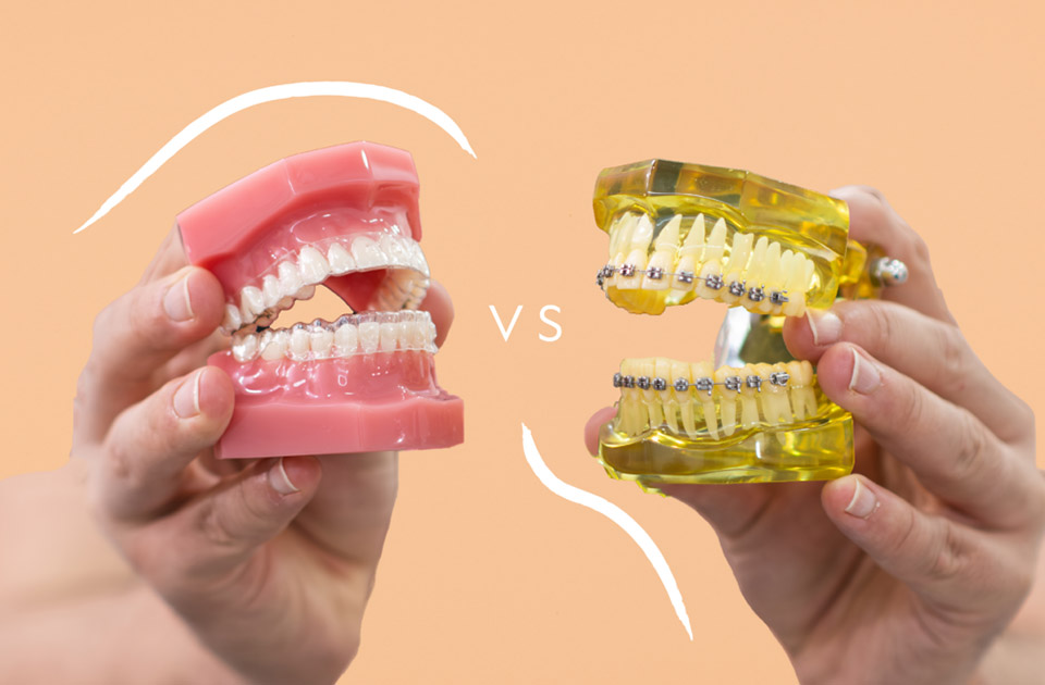 مقایسه هزینه ها