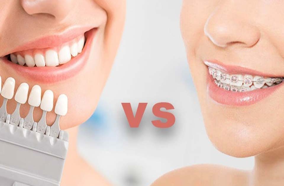 دندانپزشکی شبانه روزی ، دندانپزشکی در کرج ، دندانپزشکی خوب در کرج ، کامپوزیت دندان ، ارتودنسی دندان ، کامپوزیت دندان در کرج