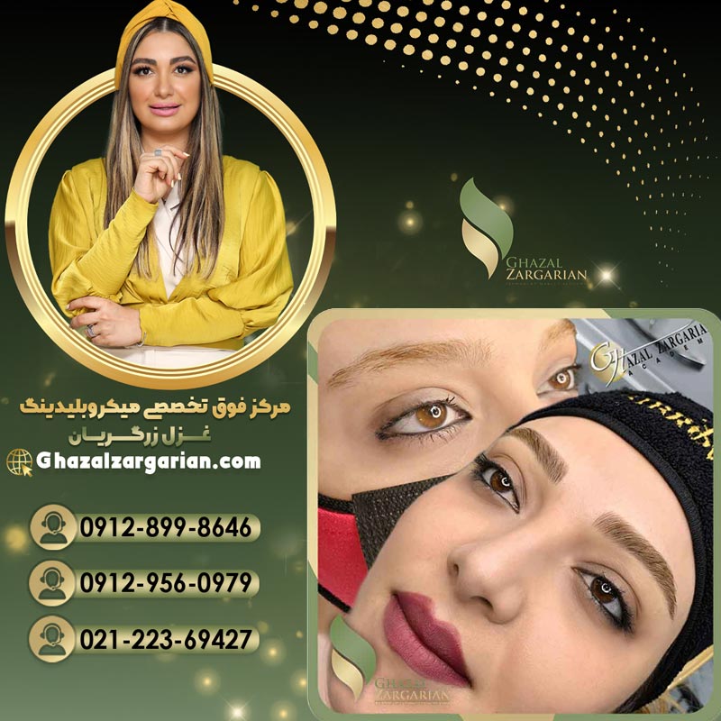 میکروبلیدینگ غزل زرگریان قرینه و دخترانه