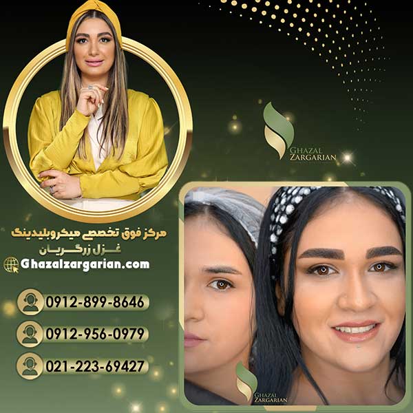 میکروبلیدینگ ابرو به روش فیبروز در بهترین سالن