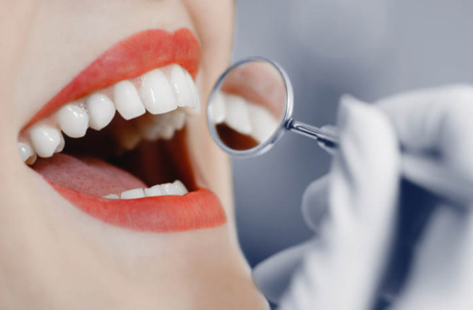 نقش دندانپزشک و جل.گیری از افتادن لمینت دندان 