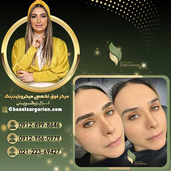 میکروبلیدینگ ابرو با بهترین کیفیت در تهران