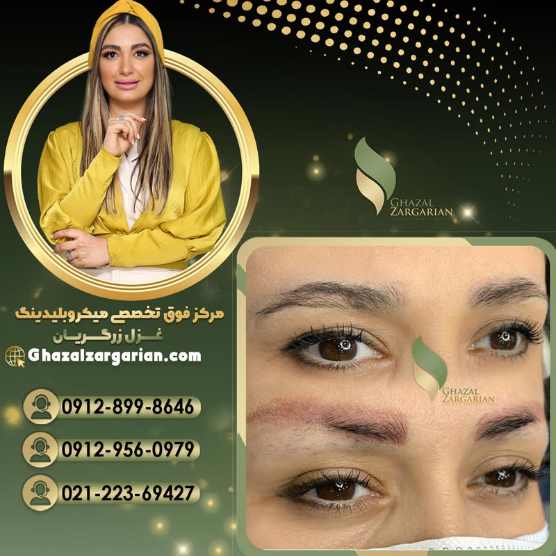 پاک کردن تاتو ابرو بدون درد و عارضه