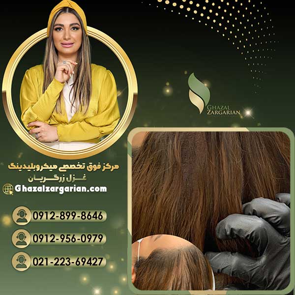 هاشور اسکالپ سر با ظاهری طبیعی و نچرال