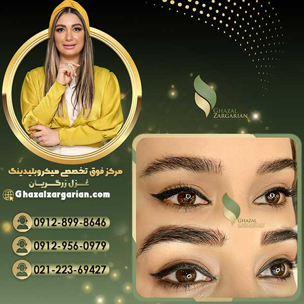ریموو تاتو ابرو با روش های جدید