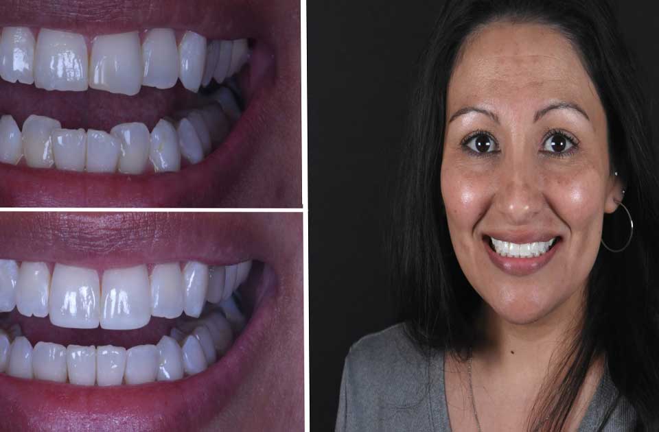 دندانپزشکی شبانه روزی ، دندانپزشکی در کرج ، بهترین دندانپزشکی ، کلینیک تخصصی دندانپزشکی ، کرج ، شبانه روزی ، کامپوزیت دندان در کرج ، ارتودنسی دندان در کرج