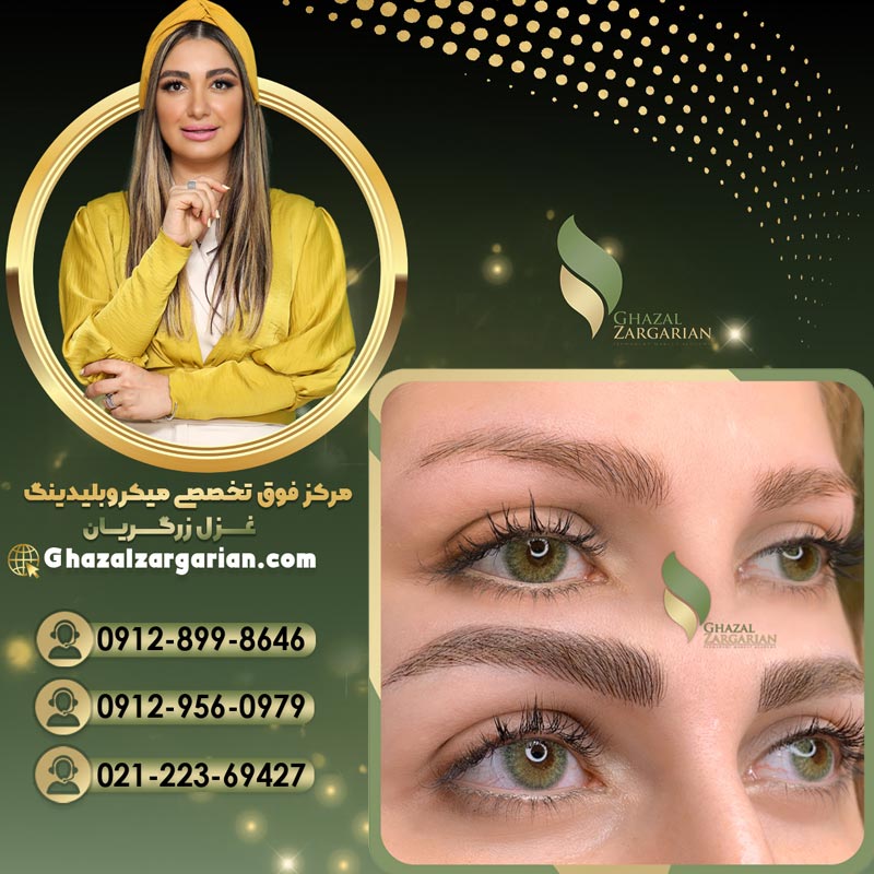 بهترین سالن فیبروز در شمال تهران با خدمات تخصصی