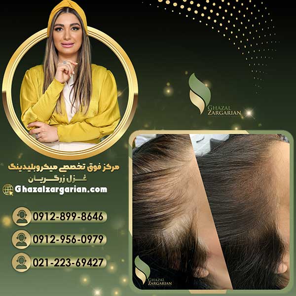 آموزش اسکالپ سر با بهترین کیفیت