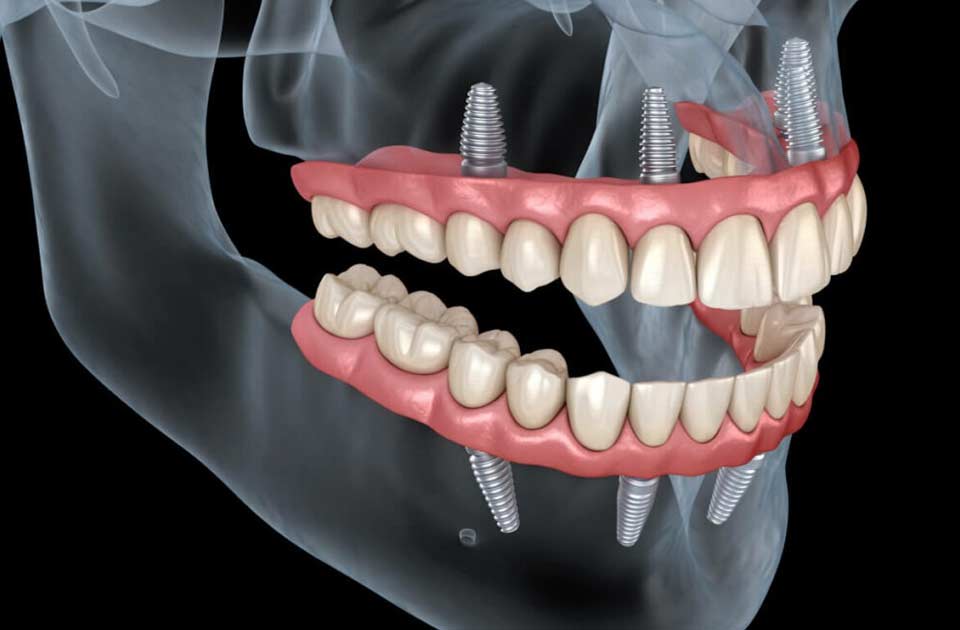 دندان ، دندانپزشکی شبانه روزی ، دندانپزشکی کرج ، دندانپزشکی دریا 