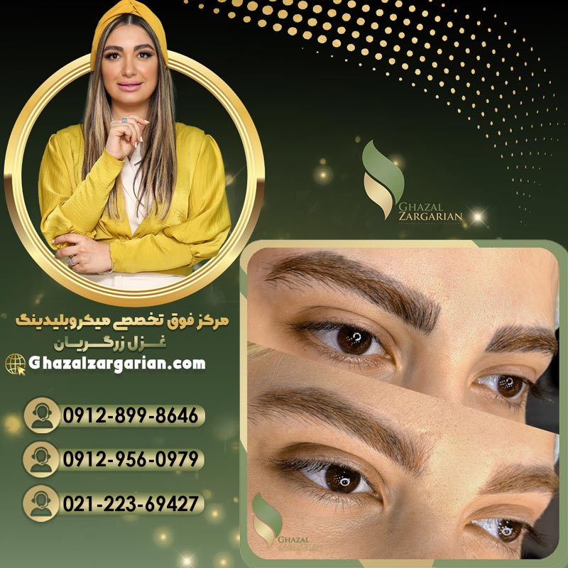 پاک کردن میکروبلیدینگ ابرو در تهران