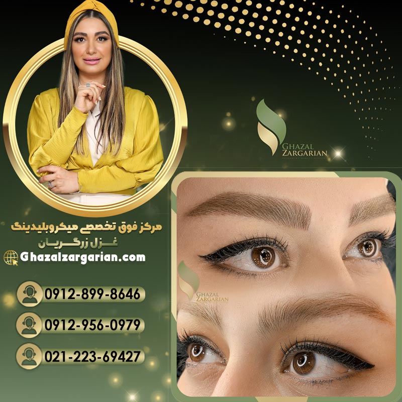 میکروبلیدینگ غزل زرگریان با بهترین تکنیک ها