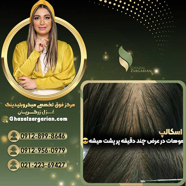 هاشور اسکالپ سر با پیگمنت های باکیفیت